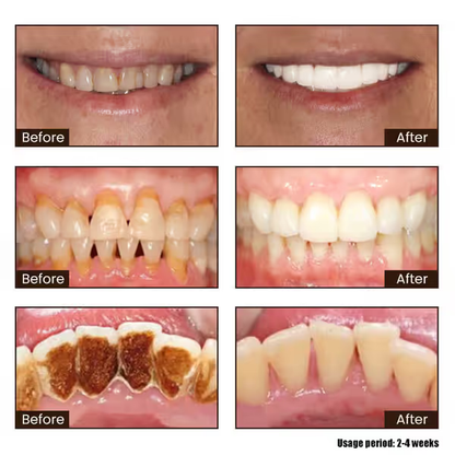 7-Pro Intensive Whitening Toothpaste – Purple Formula with 7 Probiotics for a Brighter, Fresher Smile