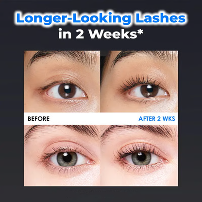 Essential Eyelash Growth Serum, Jumbo Size 0.5fl.oz - Safe & Gentle Lashes Care, Fuller, Thicker in 2 Weeks, Non-Prostaglandin, Hormone-free