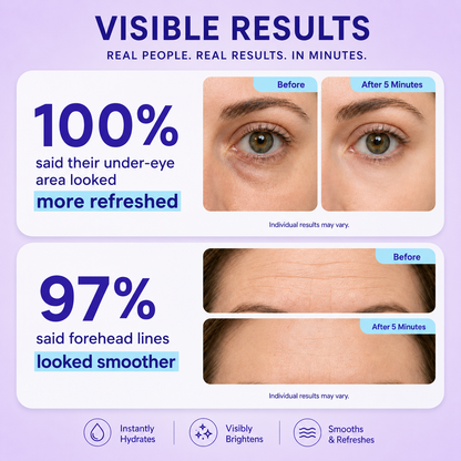 Instant Lift Eye Gel – Refreshes the Look of Puffiness, Dark Circles & Fine Lines