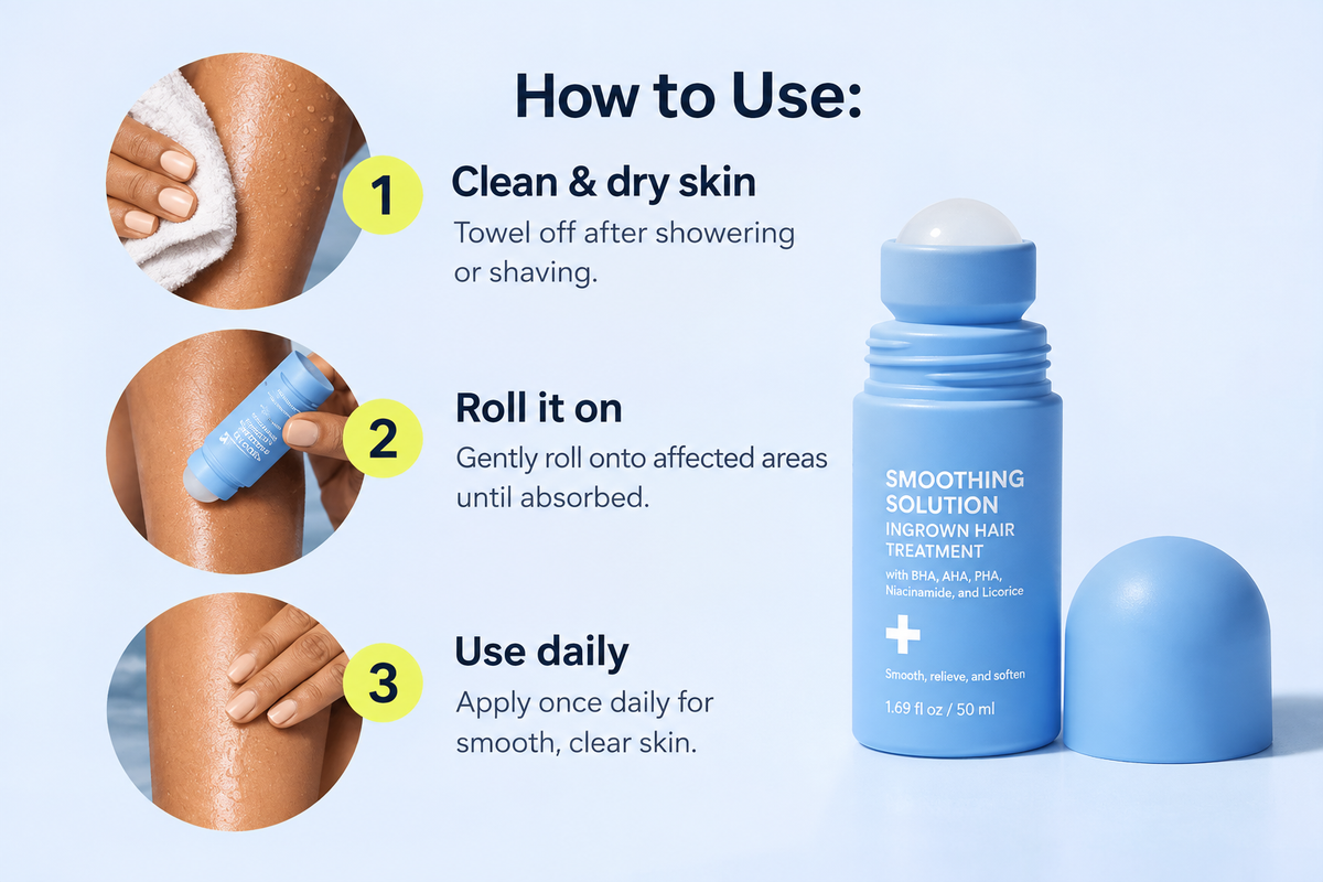 SMOOTHING SOLUTION INGROWN HAIR TREATMENT