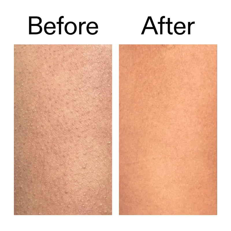 Glycolic Acid Exfoliating Body Stick – Smooth & Even-Looking Skin